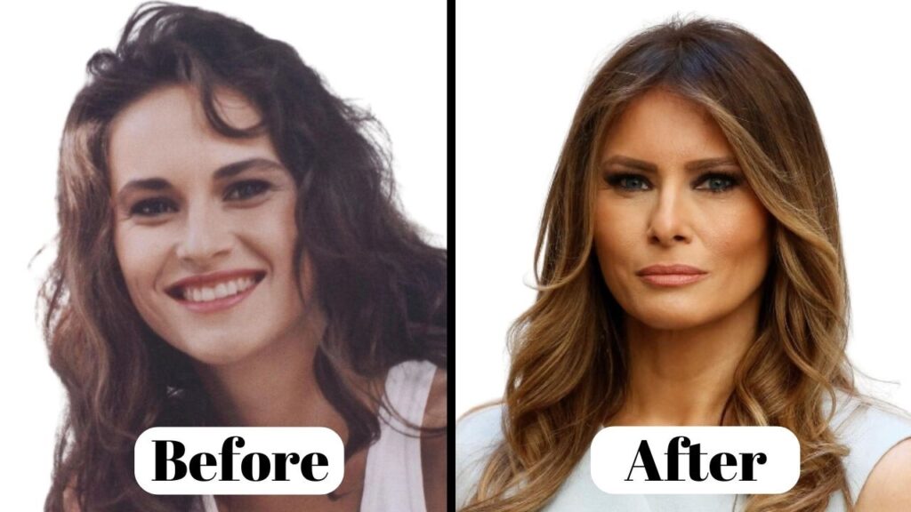 Melania Trump no Makeup